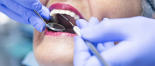 Best Emergency Dental Care for Broken or Chipped Teeth in Russellville, AR
